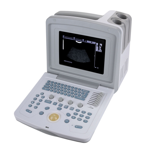 Система ультразвуковая диагностическая медицинская CMS600B3 фото 2